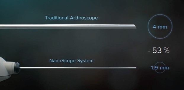 Arthroscopic Surgery in Progress