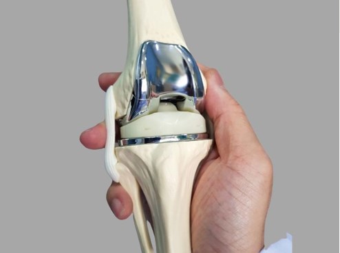 Joint Replacement Surgery